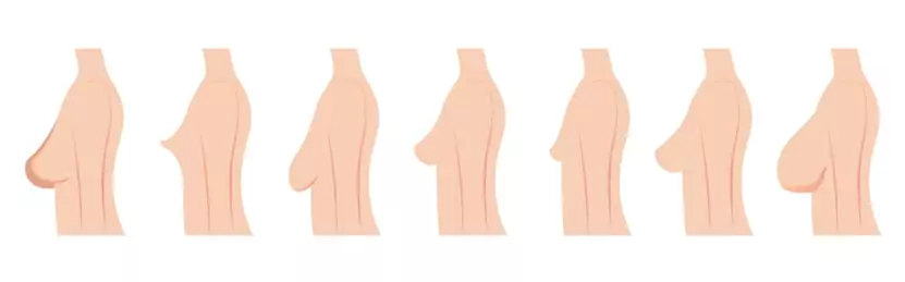 Complete visual guide showing different breast shapes including round, teardrop, bell, asymmetric, athletic, and east-west shapes with bra recommendations for each type